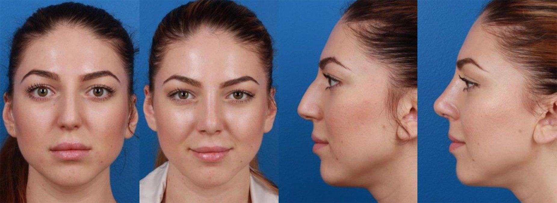best of Surgery new City york plastic facial