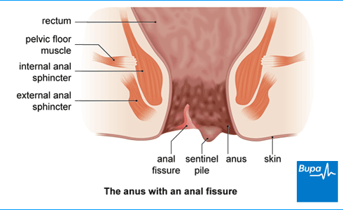 Side affects of huge anal penetration pics