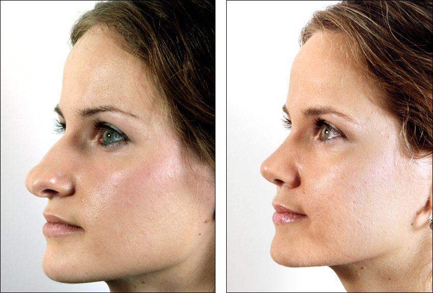 Dr dennenberg facial feminization