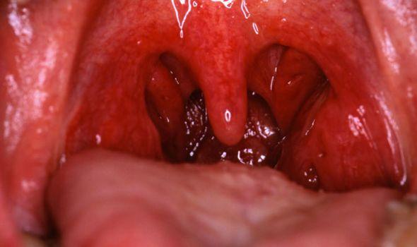 New Y. reccomend Sore vagina sore skin sore throat