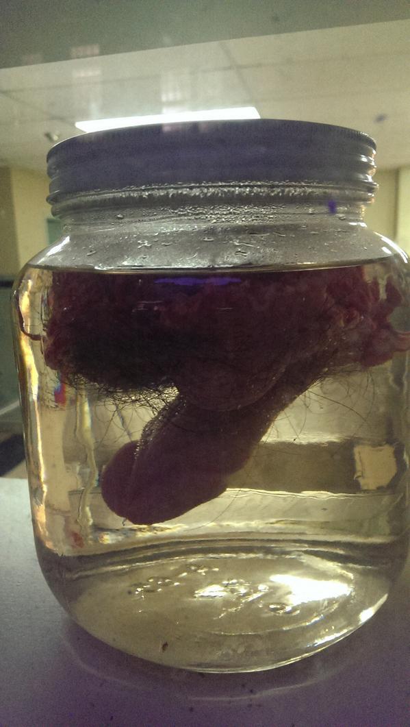 Red Z. reccomend Penis in a jar