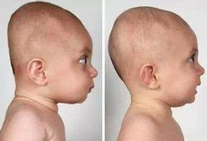 best of Babies flat head Asian