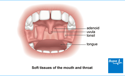 best of And adenoids Adult sore throat
