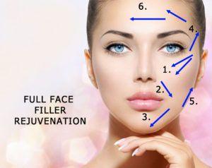Gr8 B. reccomend Facial injections for rejuvination