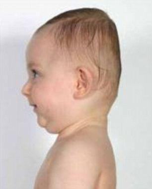 Halfback reccomend Asian babies flat head