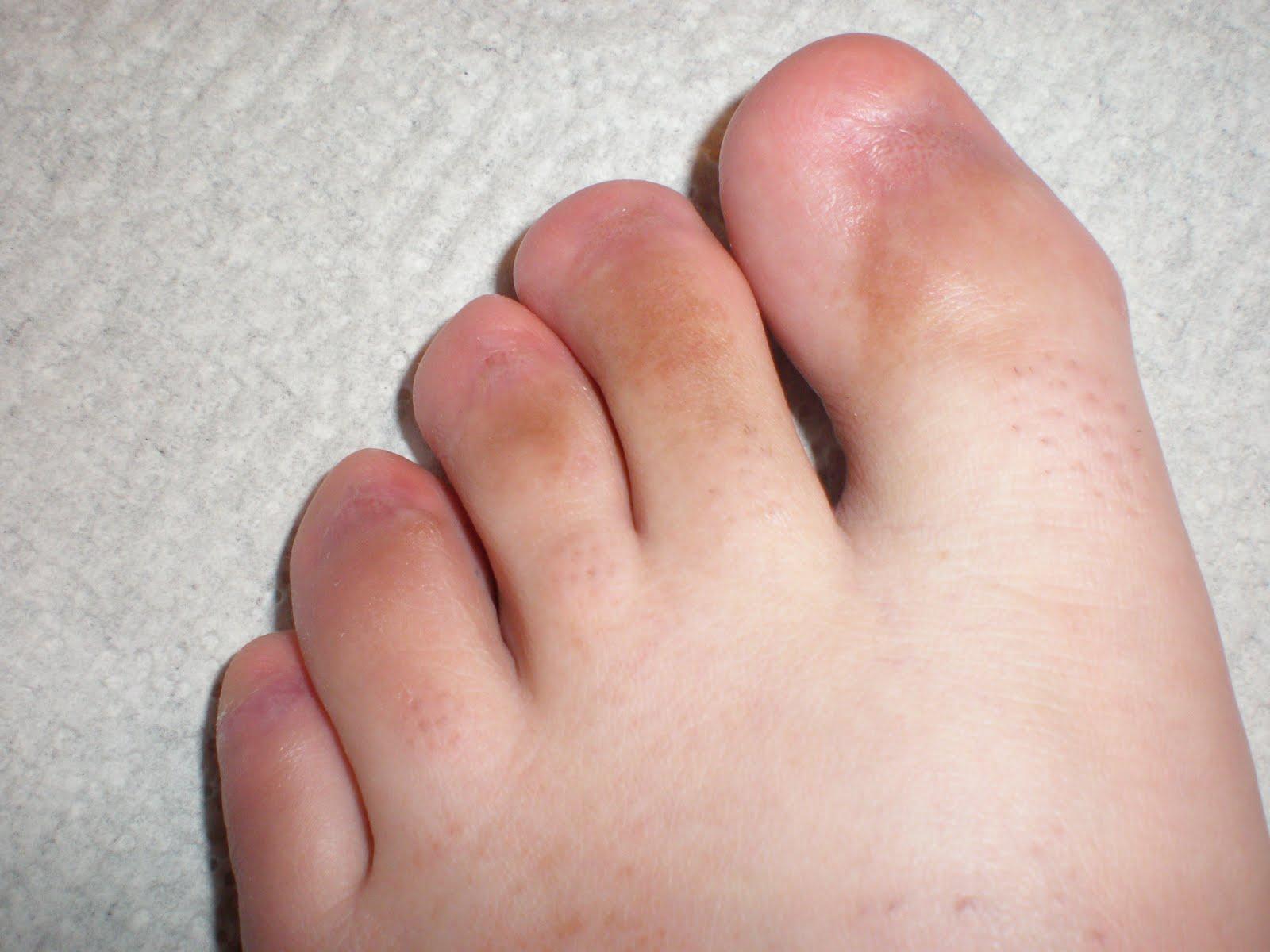 Black fetish foot pic