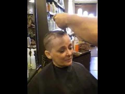 best of Brain surgery Hair shaved for