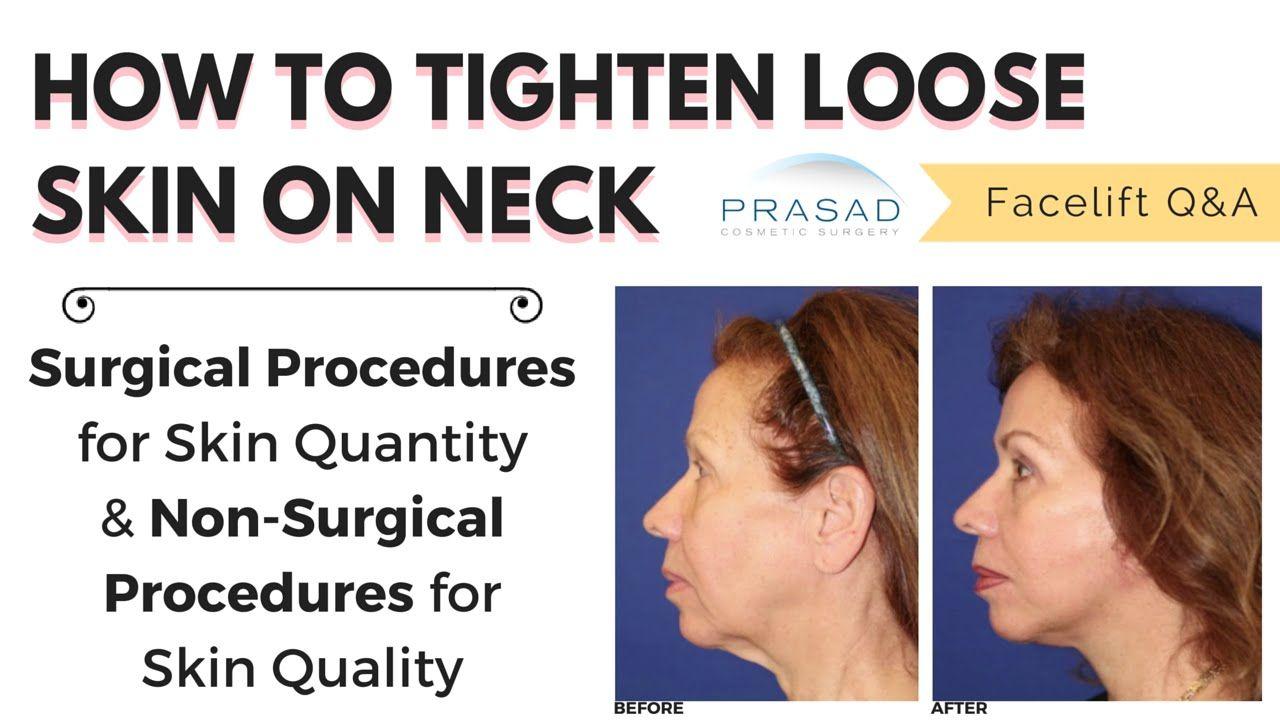 Brown S. reccomend Tighten facial skin under the neck
