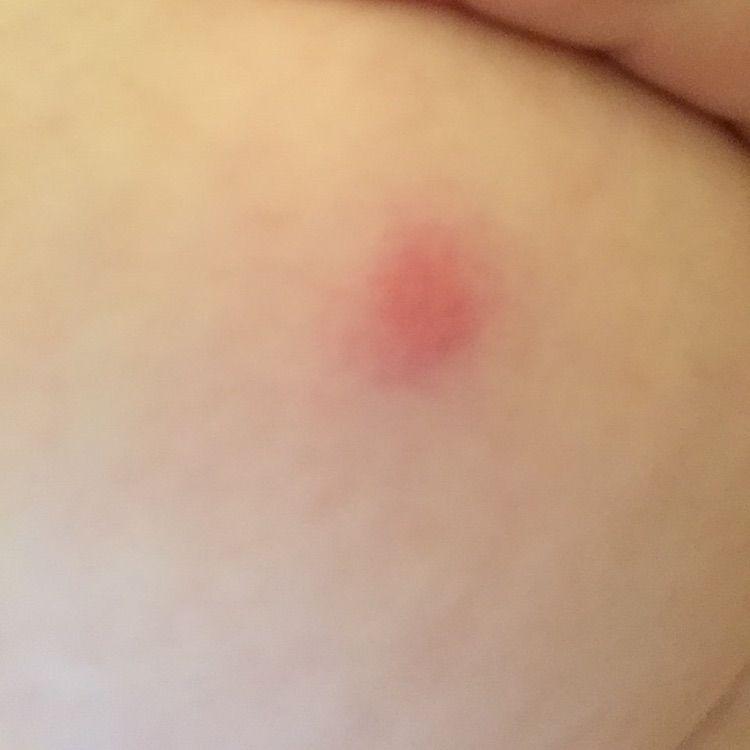 best of My boob Bite