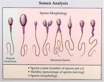 best of Kill sperm Urine
