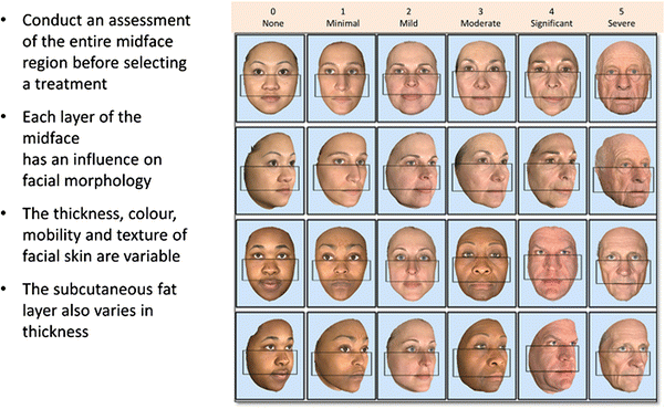 Southpaw reccomend Facial aesthetic assessment