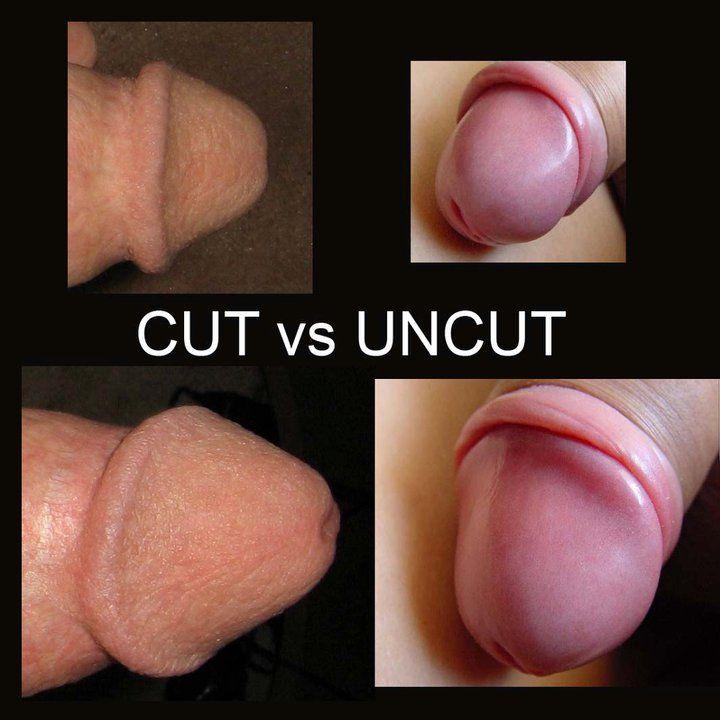 Cut uncut dicks blog