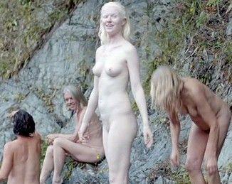 Albino black women naked