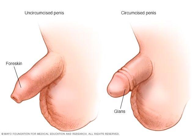 Scuttlebutt reccomend Before and after photos of adult circumcision