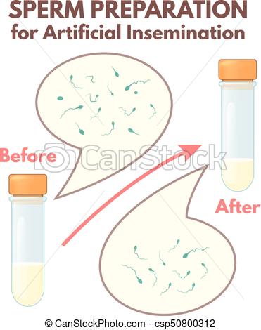 Sperm preparation for artificial insemination