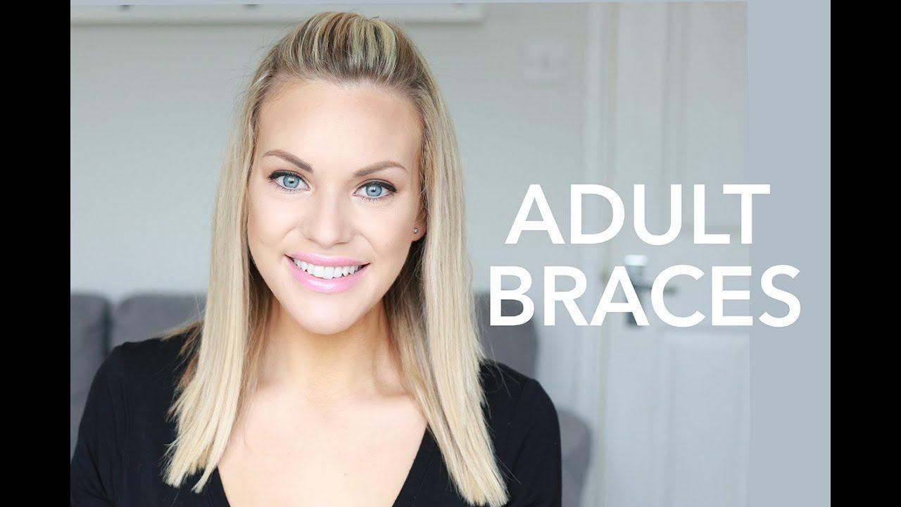 Getting Braces As An Adult Excellent Porn