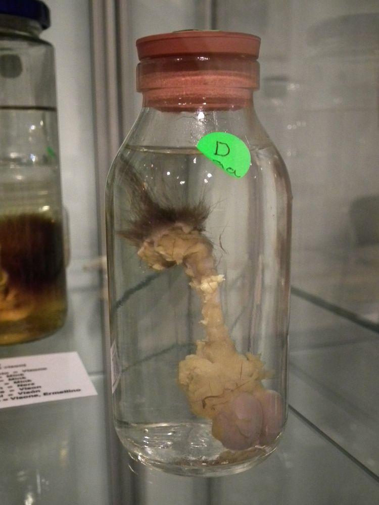 Penis in a jar