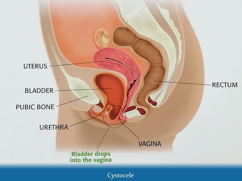 Sam reccomend Pregnancy pressure in vagina and butt
