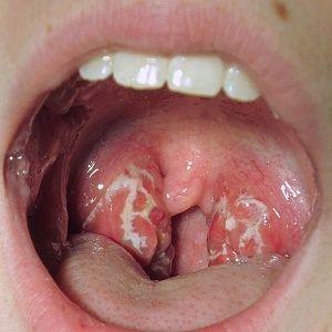 Starfire reccomend Sore vagina sore skin sore throat