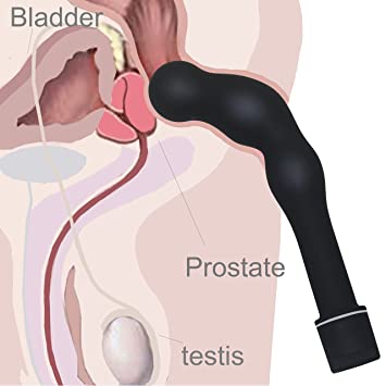 The prostate and anal intercourse